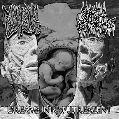 Monosodium Glutamate : Dreams into Putrescent